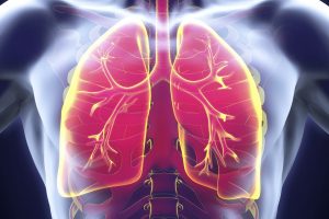 Emphysème pulmonaire