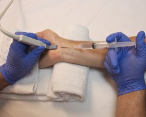 Infiltrations-de-cortisone