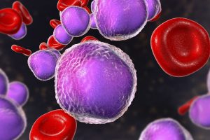 Leucémie lymphoïde